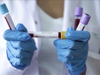 NEOČEKIVANO OTKRIĆE: Ovo bi moglo pomoći u predviđanju pozitivnih i negativnih testova na koronavirus…