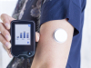 KANTON SARAJEVO: Ukinuta dobna granica za pravo na senzore za dijabetičare
