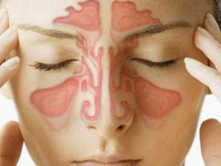 SVE JE VRLO JEDNOSTAVNO: Kako olakšati tegobe i riješiti problem upale sinusa i začepljenog nosa…