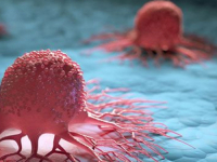 NAJCRNJE PROGNOZE: Broj slučajeva jedne vrste raka mogao bi se udvostručiti u sljedećih 20 godina…