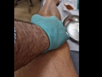IBRAHIMOVIĆ OBJAVIO ŠOKANTAN SNIMAK: Pogledajte šta mu doktori rade sa koljenom svake sedmice (VIDEO)