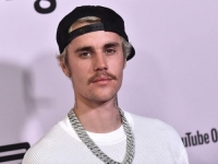DRAMATIČNO STANJE POPULARNOG PJEVAČA: Justinu Bieberu bolest paralisala pola lica, ali to nije najteže... (VIDEO)