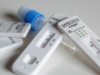 MOŽDA SE PITATE: Kako znati je li vašem kućnom testu na covid istekao rok trajanja?