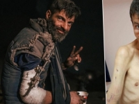 ŠOKANTNA FOTOGRAFIJA: Slika heroja Azovstala obišla je svijet, a evo kako izgleda nakon puštanja iz ruskog logora (FOTO)