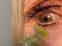 NEVJEROVATNO: Starijoj ženi u Sjedinjenim Američkim Državama iz oka izvađene...