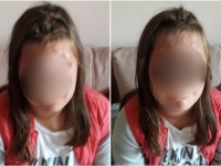 STRAVIČAN SLUČAJ VRŠNJAČKOG NASILJA U MAGLAJU: Malenu Laru tukli bokserom, njena majka strahuje od najgoreg