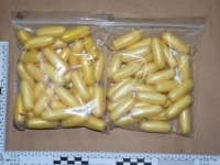 NEVJEROVATNO: Transrodna osoba iz Brazila progutala 117 kapsula kokaina, rendgenskom snimkom...