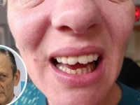 OŠTETILI SJEKUTIĆE PRILIKOM GASTROSKOPIJE: Direktor bolnice uputio izvinjenje spikerici, rekavši da se osjeća poniženo