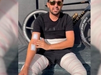 OBJAVIO VIDEO NAKON OPERACIJE: Jednom od najboljih biciklista svih vremena odstranjeno više od 100 tumora...