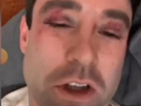 'REBRA SU MI U MODRICAMA': Poznatog meteorologa pretukla grupa tinejdžera, ubrzo se oglasio... (VIDEO)