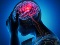 VELIKO OTKRIĆE: Znanstvenici otkrili da poseban oblik lijeka može pomoći u liječenju nakon moždanog udara…