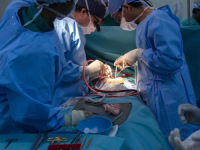 KONZUMIRA GA VELIKI BROJ LJUDI: Muškarcu eksplodirao žučni mjehur zbog predoziranja popularnim začinom