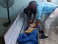 JEZIVO: Ženu proglasili mrtvom, 'oživjela' dok su je pripremali za sprovod...