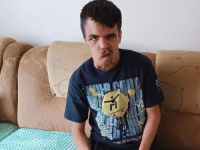 APEL IZ UDRUŽENJA POMOZI.BA: Pomozimo Amelu da ukloni tumor s lica