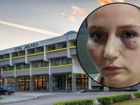 NAJOŠTRIJE OSUDILI NASILJE: Agencija za ravnopravnost spolova BiH se pridružuje protestima zbog pretučene radnice hotela Jablanica