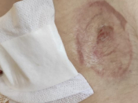 NESVAKIDAŠNJI SLUČAJEVI: Kornjače napadaju kupače u Dalmaciji, žena završila u bolnici