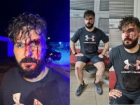 BRUTALNO PRETUČENI NOVINAR U BRČKOM: 'Imam devet šavova, zapamtio sam automobil'
