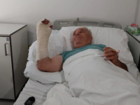 'RUKA MI JE VISILA DRŽEĆI SE SAMO ZA KOŽU': Čovjeku cirkular potpuno otkinuo šaku