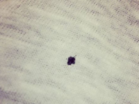 TRIKOVI KOJI MOGU RIJEŠTI NAŠE EVENTUALNE PROBLEME: Evo kako da uklonite rupice sa tkanine