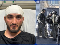 U BLIZINI DŽAMIJE AL-AKSA: Izraelske snage teško pretukle fotoreportera Anadolije Mustafu Harufa (VIDEO)