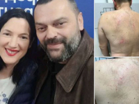 INCIDENT U ZVORNIKU: Pretučen član Glavnog odbora stranke Jelene Trivić -'Pretukla su me dva vojnika SNSD-a...' (VIDEO)