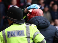 TOTALNI HAOS U KOLIJEVCI NOGOMETA: Navijači uletjeli na teren, igrači sklanjaju djecu, potekla je i krv (FOTO, VIDEO)