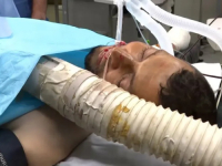 REPORTER KOME JE AMPUTIRANA NOGA: 'Nastavit ćemo naš put sve dok slika iz Gaze ne stigne do cijelog svijeta'