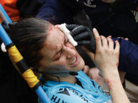 DRAMA U PRIMERI - SUTKINJA UDARILA GLAVOM U KAMERU: Krv na sve strane - nije mogla da nastavi meč (FOTO)