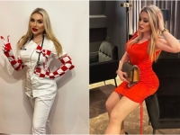 ZGODNA DOKTORICA IZ 'BRAKA NA PRVU' PRIZNALA: 'Pojedem malo ananasa i peče me jezik, a kad pojedem pola kile bureka...'