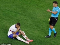 MBAPPE SE OGLASIO NAKON GADNE POVREDE NOSA: 'Imate li kakvu ideju za masku?' (FOTO)