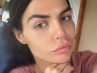 MANEKENKA SE POKAJALA NAKON ESTETSKIH ZAHVATA: 'Više nisam ličila na sebe, uvijek idite kod najboljih ljekara'