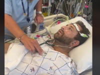 EMOTIVAN TRENUTAK: Muškarac prvi put čuo svoje srce nakon transplantacije, pogledajte njegovu reakciju (VIDEO)