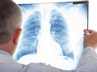 POZNATI DOKTOR UPOZORAVA: Uskoro se očekuje porast tipične i atipične pneumonije, evo šta nam je činiti…