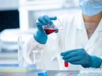 KO TO ZNA BOLJE OD CIA-e: Vjerovatnije je da je koronavirus nastao u laboratoriju nego od životinja