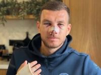 DŽEKO NAKON POVREDE NOSA POSLAO JAKU PORUKU: 'Sve ili ništa!'