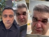 PRETUČENI MENADŽER IZ SRBIJE JAVIO SE IZ ZAGREBAČKE BOLNICE: 'Šutirao me u glavu, a bio je s...' (VIDEO)