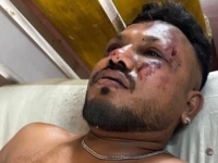 BRITANSKI DRŽAVLJANIN PREŽIVIO PAD BOEINGA U INDIJI: Ovo je njegova prva izjava (FOTO/VIDEO)
