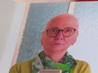 ŽIVI UŽAS: Zdravoj ženi dali tri doze kemoterapije -'Najgore su mi oči...'