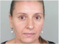 U DERVETNI NESTALA RUŽICA NEDINIĆ: Posljednji put viđena 5. juna, obitelj i policija mole za pomoć