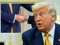 OD ČEGA BOLUJE TRUMP: Zbog ovoga nosi zavoje i šminku na ruci: Bolest je česta, a ovo su najčešći simptomi