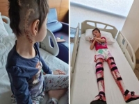 APEL UDRUŽENJA POMOZI.BA: Djevojčica Medina je imala čak 31 operaciju na mozgu - sada joj treba još jedna...