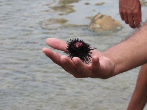 AKO VAS OPEČE MEDUZA ILI STANETE U JEŽA: Ovo morate odmah uraditi