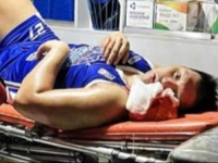 UŽAS NA TERENU: Košarkaš brutalnim udarcem slomio vilicu protivniku... (VIDEO)
