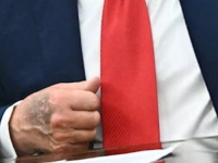 SVI BRUJE O TRUMPOVOJ LJUBIČASTOJ RUCI: Jedna poznata dama je slično imala prije smrti