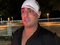 PRVE FOTOGRAFIJE DARKA LAZIĆA NAKON TEŠKE NESREĆE: Glava u zavojima i brojne posjekotine, još se ne zna u kakvom je stanju njegova supruga