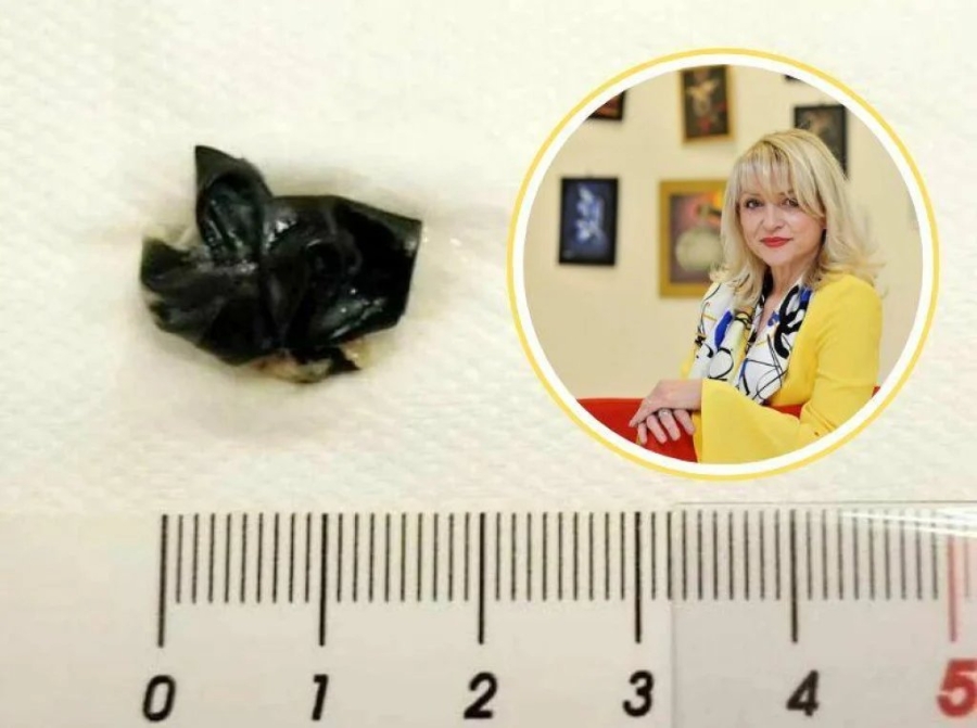 MAMA DOVELA SINA NA PREGLED, DOKTORICA OSTALA U ŠOKU KAD JE VIDJELA ŠTA IMA U NOSU: Mjesecima bilo unutra...