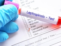 POTVRĐENO: Kraj epidemije leptospiroze u Kantonu Sarajevo