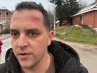 NAPADNUT POLITIČAR DAO IZJAVU ZA MEDIJE I OPTUŽIO VUČIĆEVU STRANKU: 'Udarali su me šipkom, suprotstavit ćemo se SNS-u'