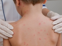 HOROR U SUSJEDSTVU: Preminuo devetogodišnji dječak, imao boginje i visoku temperaturu