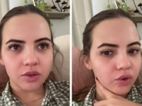 DVA PUTA PONOVILA ISTU GREŠKU: Influencerica pokazala posljedice koje ima od botoksa (VIDEO)